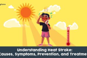 Heat Stroke: Causes, Symptoms, Prevention, and Treatment